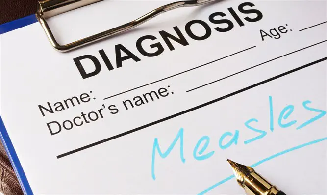 Measles diagnosis